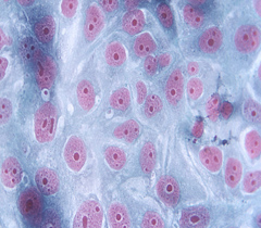 細胞侵襲、轉染